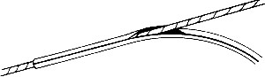 Davis Cable Cover 3 32